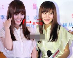 整容医生爆料视频大全集,医生爆料视频大全集深度解析 第2张 整容医生爆料视频大全集,医生爆料视频大全集深度解析 第2张